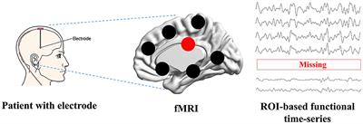 U-shaped convolutional transformer GAN with multi-resolution consistency loss for restoring brain functional time-series and dementia diagnosis